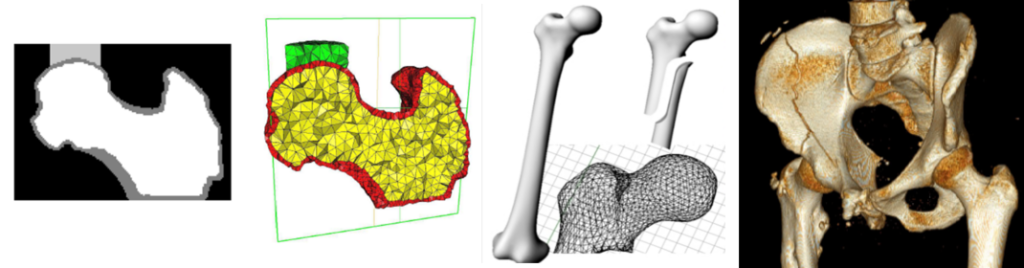 Generación de modelos tridimensionales de huesos humanos para fines de exploración y cuantificación ósea